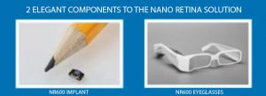 elegant components to the nano retina solution