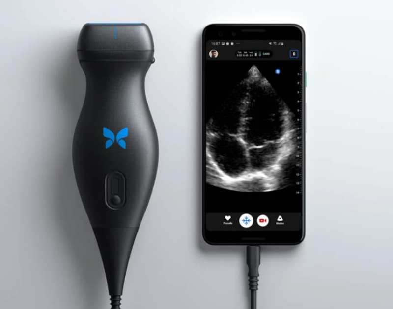 Portable ultrasound system – ‘BUTTERFLY IQ’