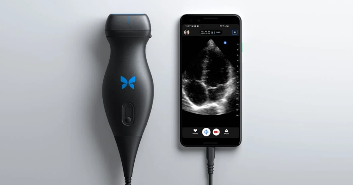 Portable ultrasound system – ‘BUTTERFLY IQ’