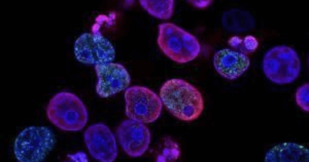 Study suggests cancer cells may evade chemotherapy by going dormant