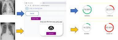 Artificial intelligence based tool to detect covid-19 from chest x-ray by IIT Gandhinagar