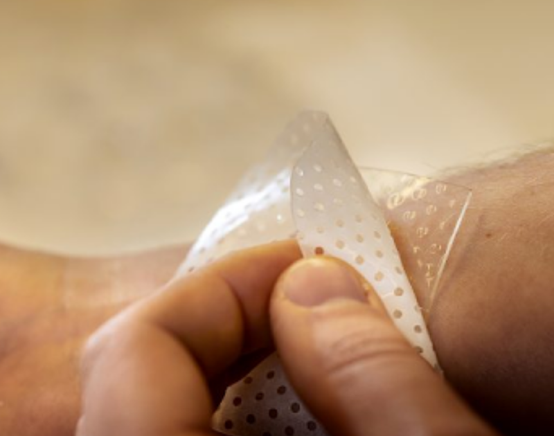 Innovations in hydrogel technology are transforming wound care