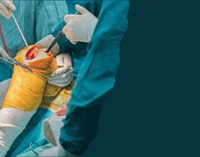 Handling of the fragile patient in arthroplasty