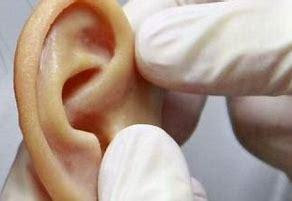 Replacement Ear Made From Ear Cells