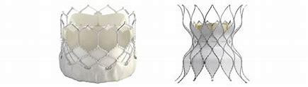 Sapien3 Transcatheter Pulmonary