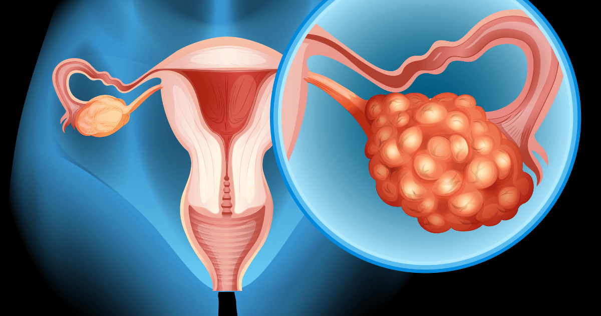 Adolescent Polycystic ovarian syndrome: An entity well known but still unknown