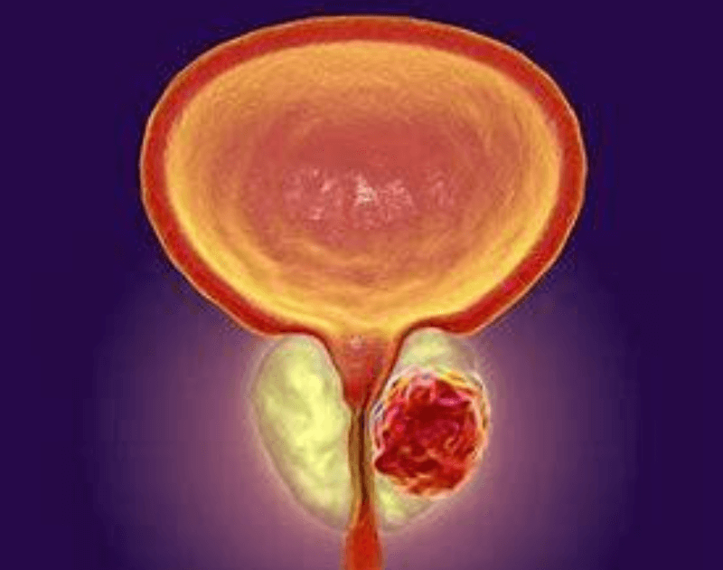 Psma-targeted Therapy_featured image